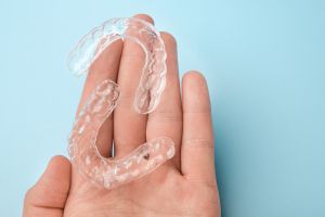 4 Things To Know About SureSmile Clear Aligners