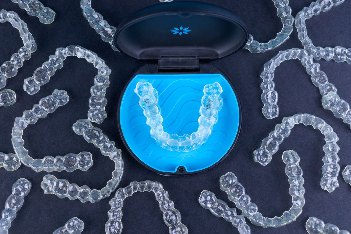 Braces vs Clear Aligners: What’s the Difference?