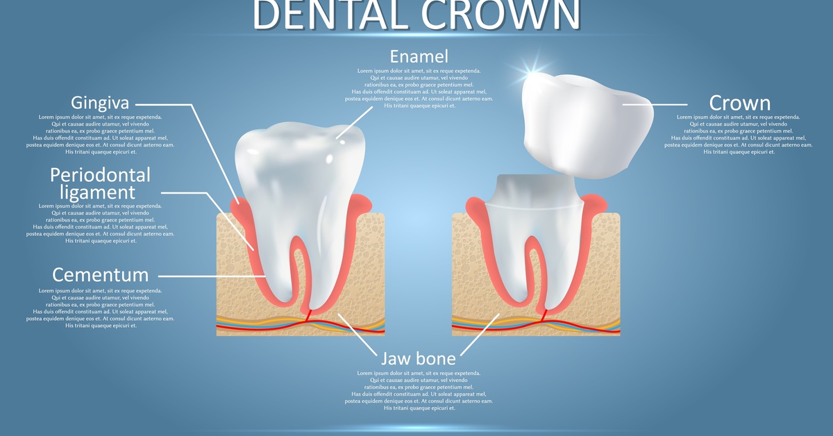 A digital demonstration of a dental crown, showing two types of teeth, each part of the tooth labeled with descriptions.