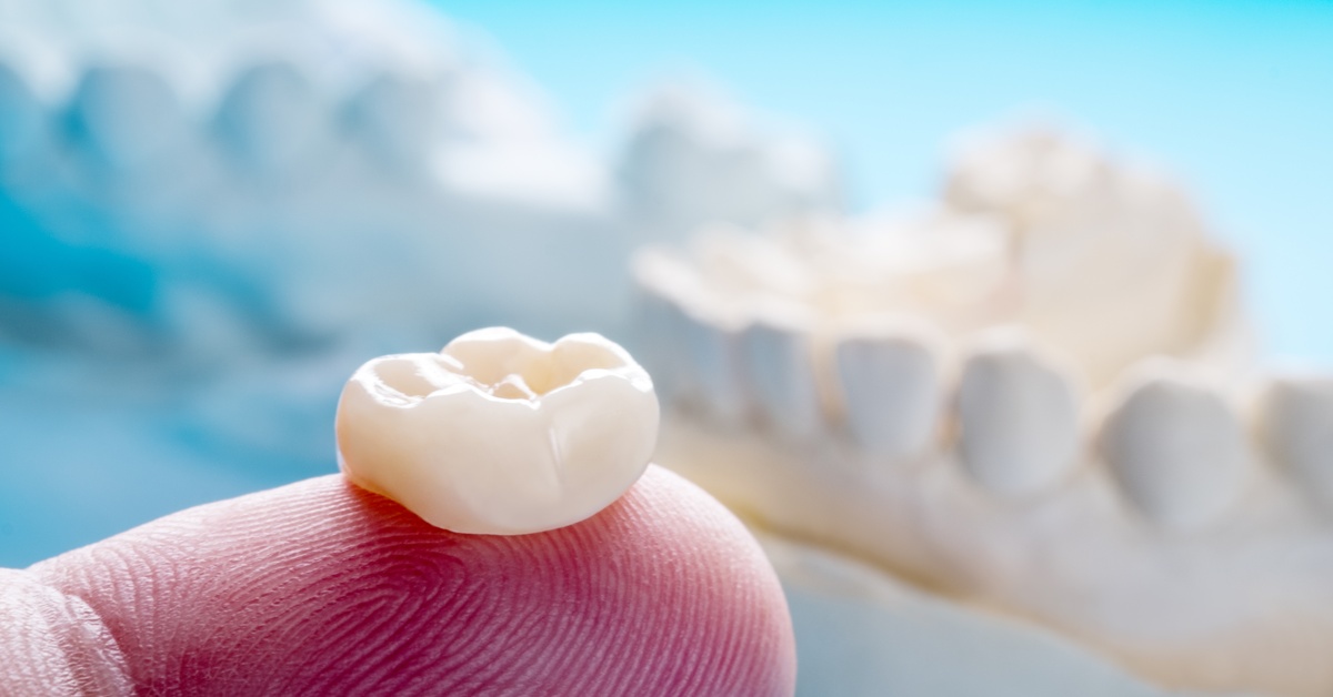 A close-up of a dental crown sitting on top of a finger tip. A white, blurry dental model is in the background.