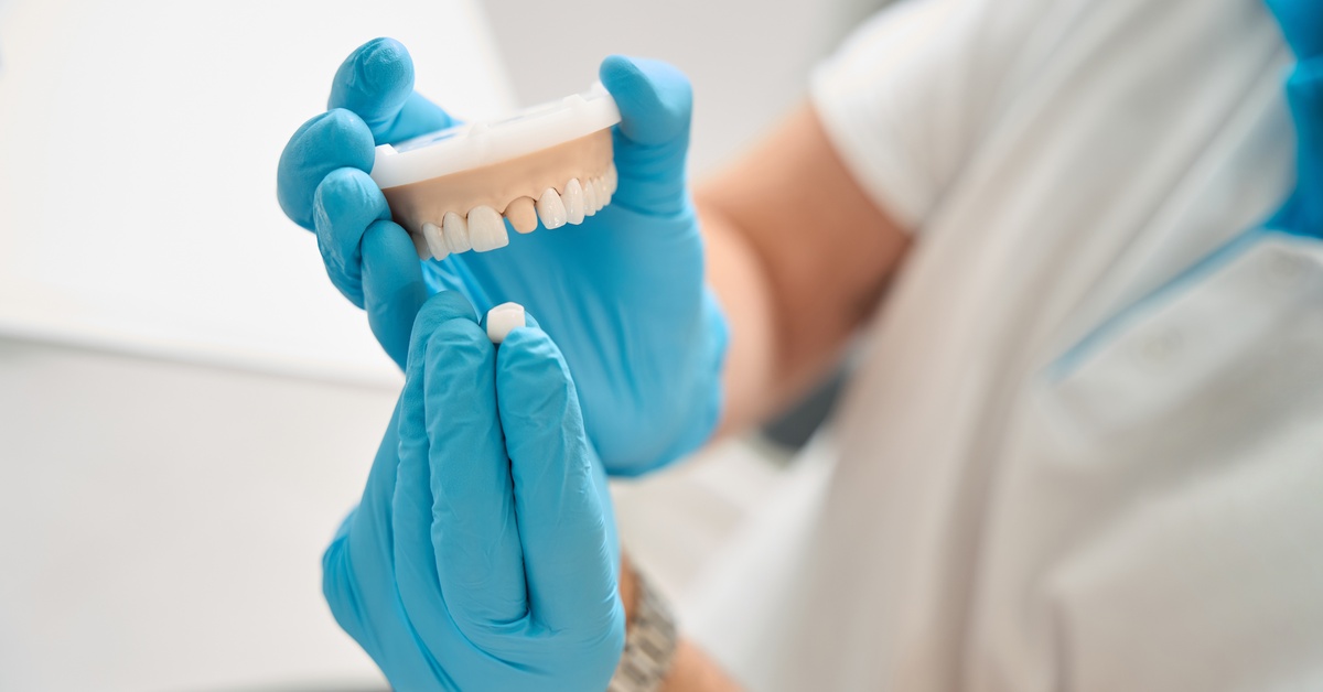 A dentist wearing blue gloves is holding a dental model of a top set of gums and teeth and a crown. One tooth is shaved down.