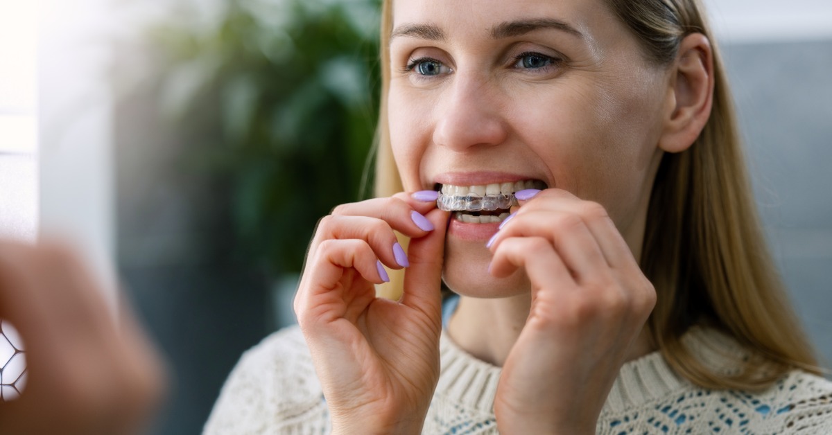 A blonde-haired woman in a white sweater placing clear aligners over her upper teeth while looking in a mirror.