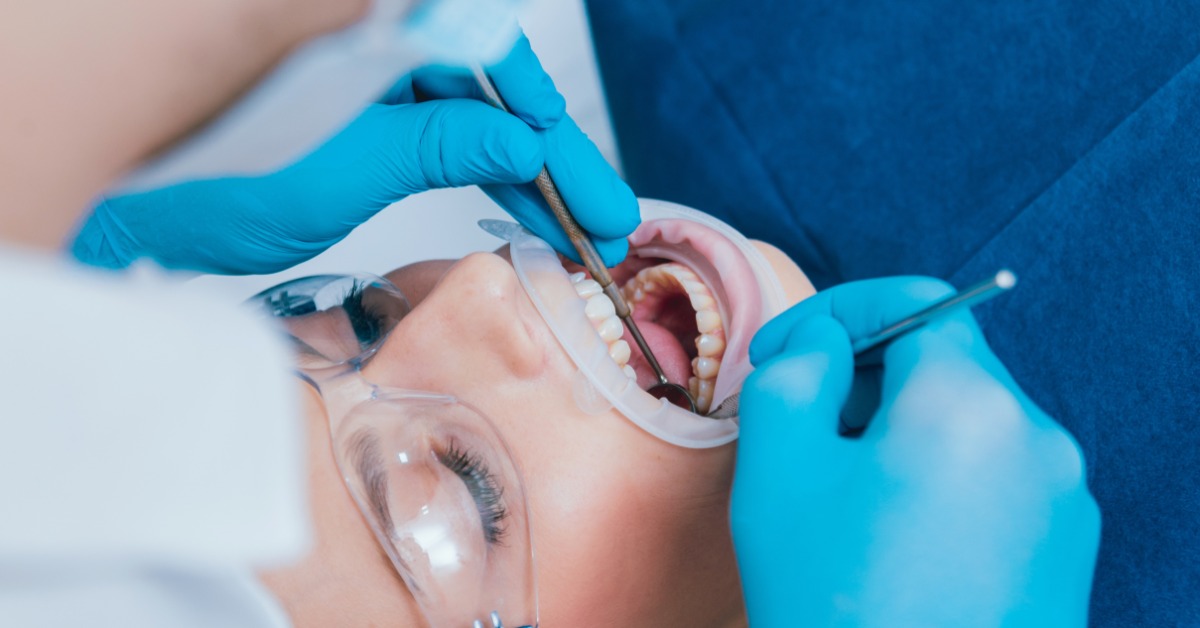 Close-up of a dentist examining a patient's teeth with dental tools while the patient wears protective glasses.
