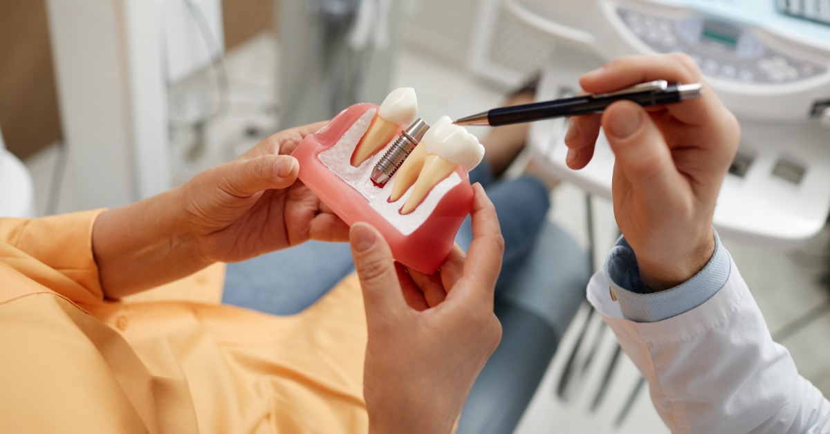 Dentist uses a dental implant model to explain how an implant post and crown replace a missing tooth to a patient.